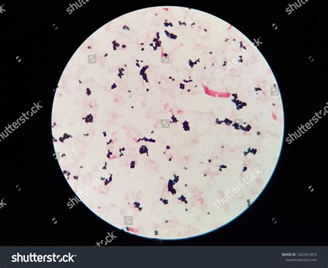Gram Positive Cocci Cluster Stock Photo 1062601853 | Shutterstock