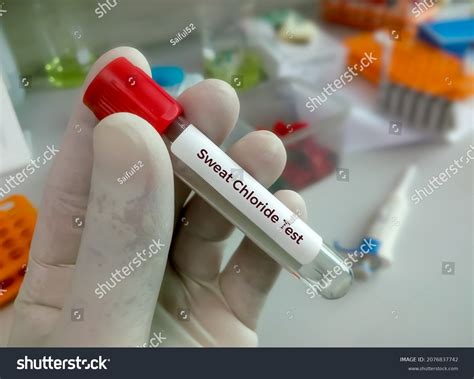 9 Sweat Chloride Testing Images, Stock Photos, 3D objects, & Vectors ...