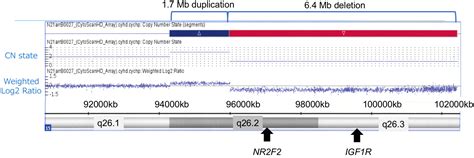 Diagnosis of Chromosome 15q-Terminal Deletion Syndrome through Elevated ...