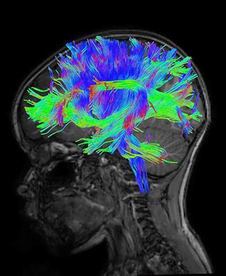 Image result for fMRI Python