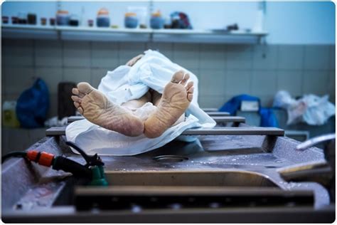 Image result for Dissection Human Postmortem