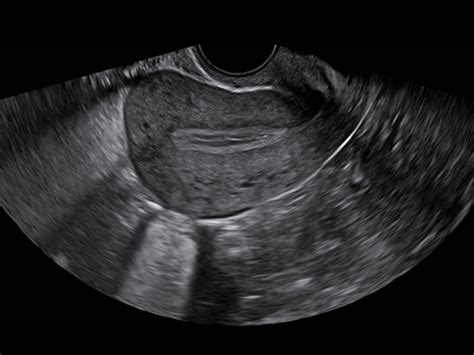 CD35 - Konica Minolta