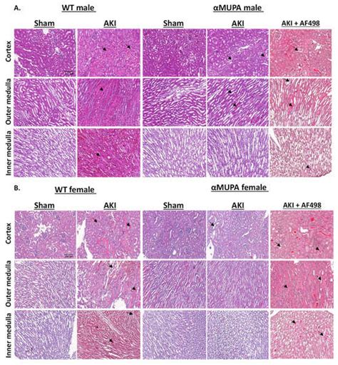 The Protective Pathways Activated in Kidneys of αMUPA Transgenic Mice ...