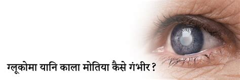 काला मोतियाबिंद (ग्लूकोमा, काला मोतिया) के लक्षण, कारण, इलाज, दवा ...