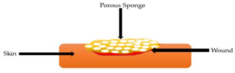 Gelatin-Based Hybrid Scaffolds: Promising Wound Dressings