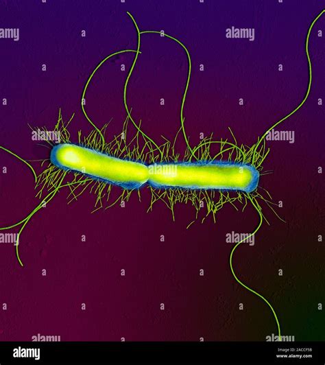 Proteus vulgaris bacteria, scanning electron micrograph (SEM). This ...