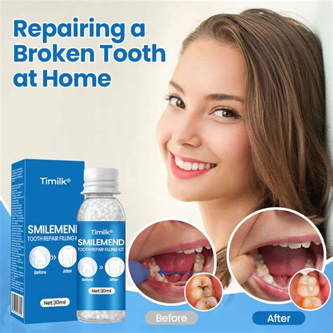 Timilk® SmileMend Tooth Repair Filling Kit – Makehuyu