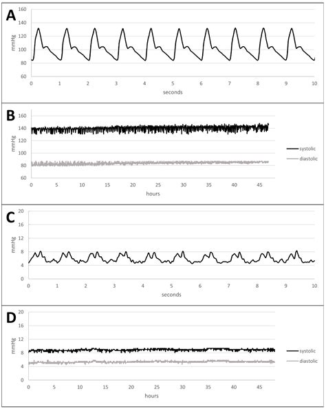 An Arteriovenous Bioreactor Perfusion System for Physiological In Vitro ...