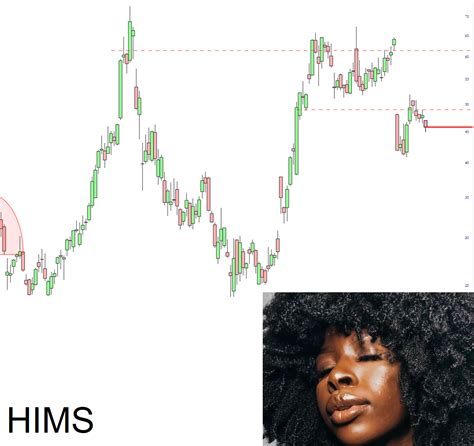 Mister Softee – Slope of Hope with Tim Knight