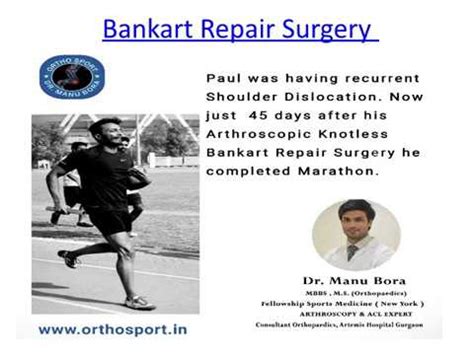 Bankart Repair Surgery in Delhi NCR - Dr Manu Bora