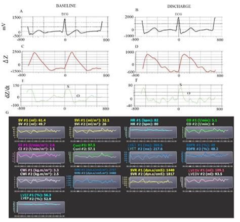 Noninvasive Hemodynamic Monitoring in Advanced Heart Failure Patients: New Approach for Target ...