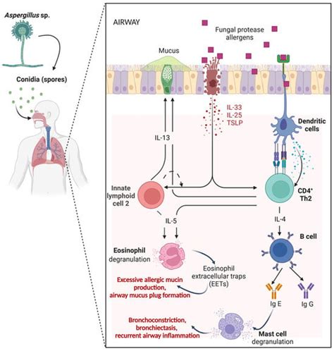 Allergic Bronchopulmonary Aspergillosis (ABPA) in the Era of Cystic ...
