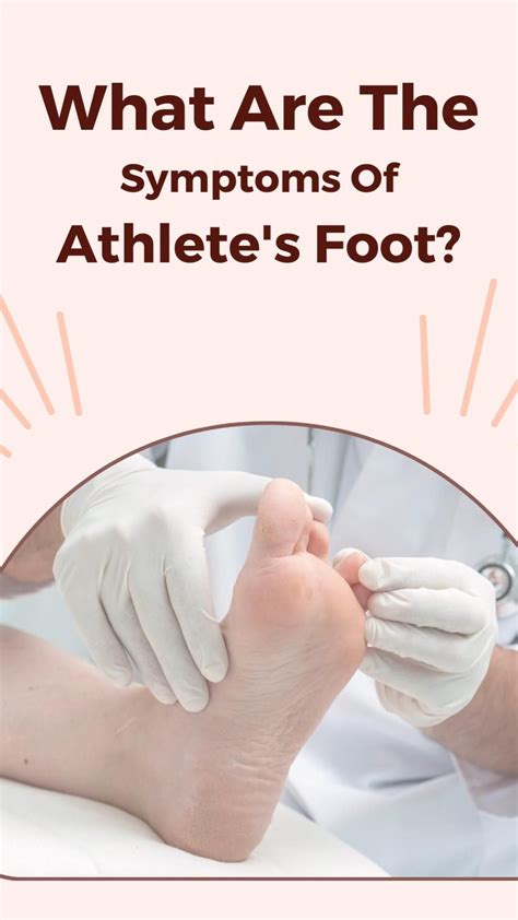 Athlete's Foot Symptoms Australia at Norman Nelson blog