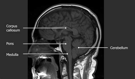Imaging of the Head and Brain | Concise Medical Knowledge