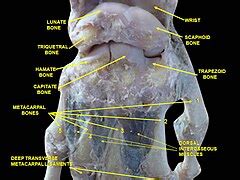 Image result for Hand Dissection
