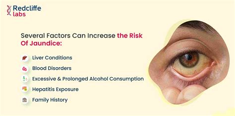 Factors that can increase the risk of jaundice