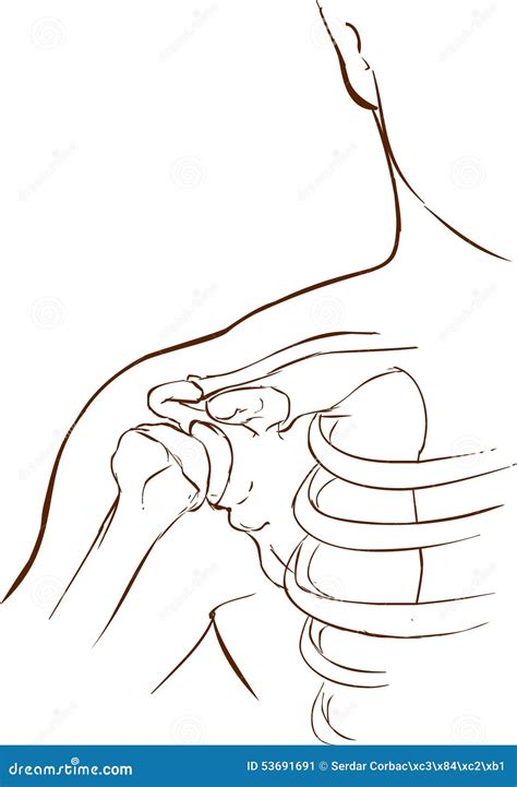 Shoulder dislocation stock illustration. Illustration of dislocated ...