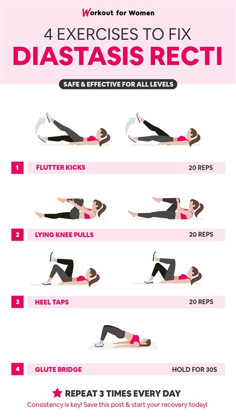 Diastasis Recti Workout