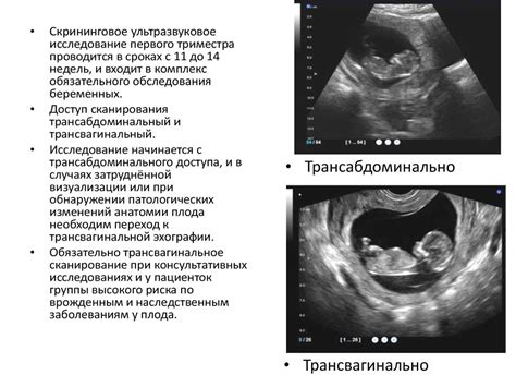 Ультразвуковой скрининг первого триместра беременности - online ...