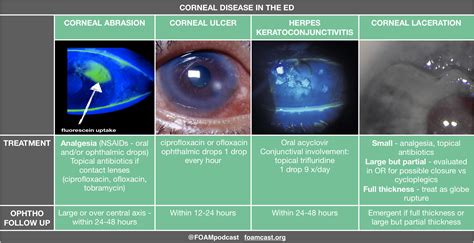 Viral Corneal Ulcer Eye Injuries — REAL First Aid
