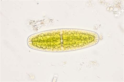 Netrium oblongum | The Microscopic Life of Shetland Lochs