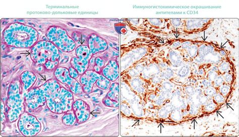 Молочная железа - нормальная гистология под микроскопом