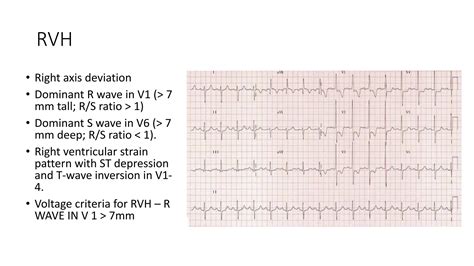 Basics of ECG.pptx