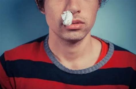 鼻子流血怎么回事怎么止血（鼻出血是怎么回事？可能与这3个因素有关，不可小看） | 说明书网