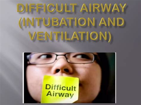 Image result for Difficult Intubation Form