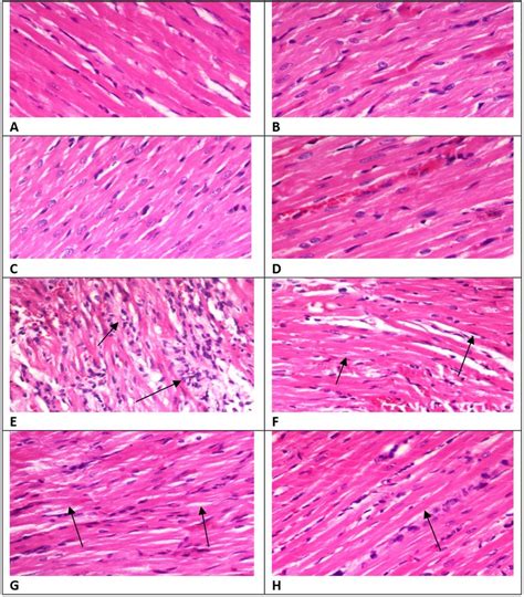 Cardiac Muscle Structure 的图像结果