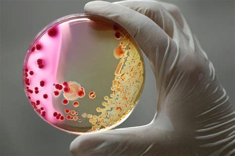 Does Refrigeration Kill Bacteria? The Cold Hard Truth Explained