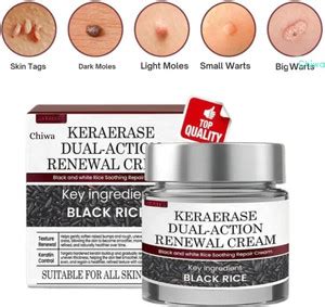 CHIWA Keraerase Dual Action Renewal Cream | For Radiant Skin For All ...