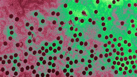 Parvovirus cases on the rise in humans: CDC