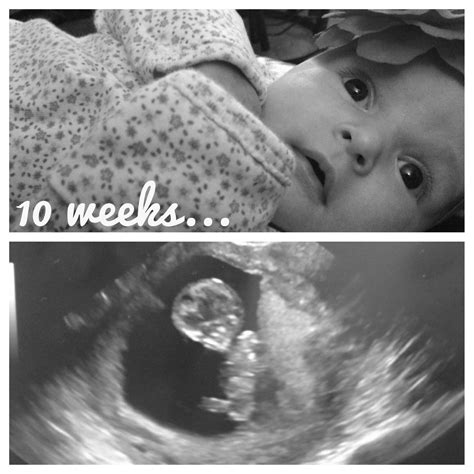 10 week ultrasound, Payton at 10 weeks old :) | Baby ultrasound ...