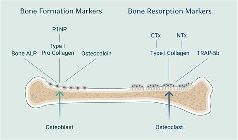 Discover Your Bone Health: Check Your Bone Turnover Markers