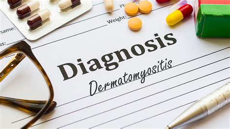 La dermatomyosite – une maladie systémique - Médecine interne ...