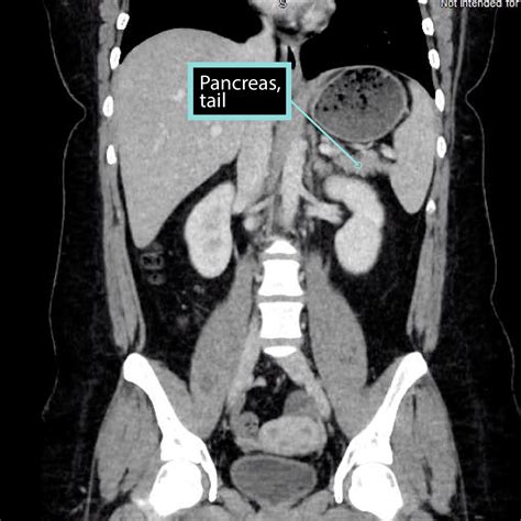 Gross Anatomy Glossary: Pancreas Imaging | ditki medical & biological ...