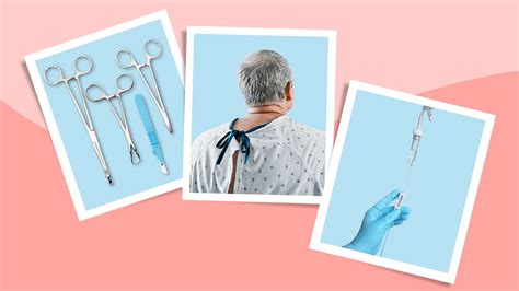 Ulcerative Colitis Surgery 的图像结果