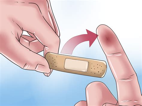 Image result for Infected Splinter Removal