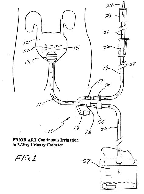 Continuous irrigation patented technology retrieval search results - Eureka | Patsnap