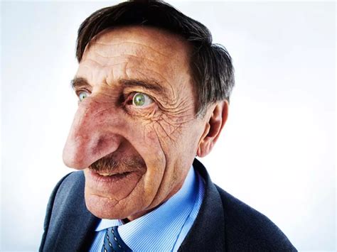 Turkish Man Named Mehmet Özyürek Has The Longest Nose In The World