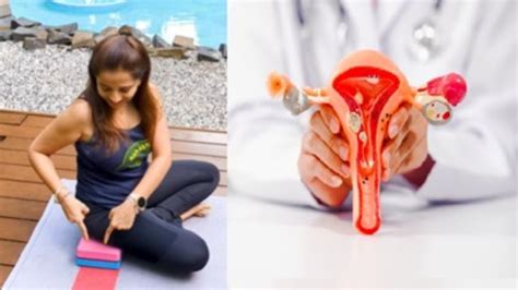 बच्चेदानी की गांठ बढ़ा सकती है आपकी मुश्किलें, एक्सपर्ट से जानें राहत ...