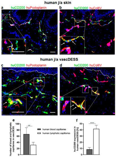 The Role of CD200–CD200 Receptor in Human Blood and Lymphatic ...