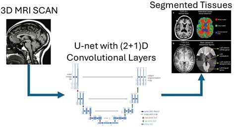 Enhanced U-Net for Infant Brain MRI Segmentation: A (2+1)D ...