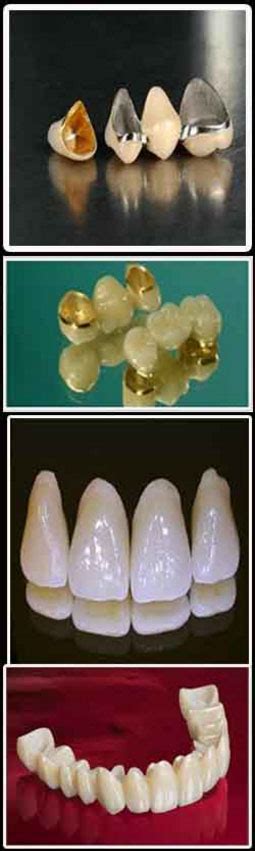 Prosthodontist in Delhi | Dr Aman Arora