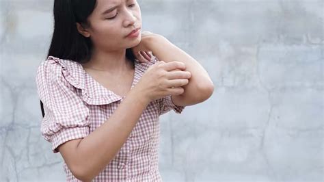 What Can Cause Extreme Itching Without Rash? – NutritionFact.in