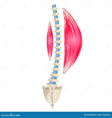 Left-sided Scoliosis. Levoscoliosis. Muscles and Spine. Spinal Curvature in Scoliosis ...