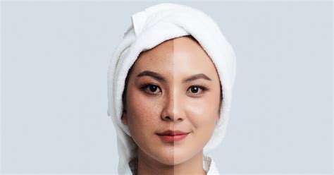 These 4 Natural Ingredients Are Great for Reducing Pigmentation – Setu ...