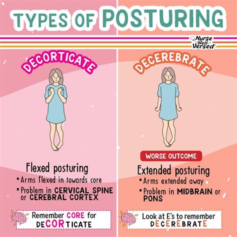 Image result for Decorticate Posture