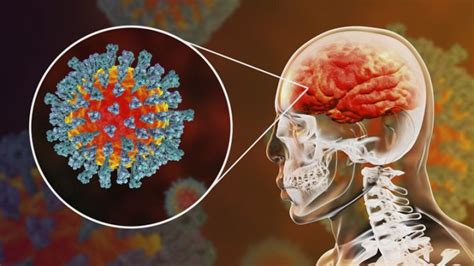 由新冠病毒也能感染神经系统想到免疫反应和强迫症 - 知乎